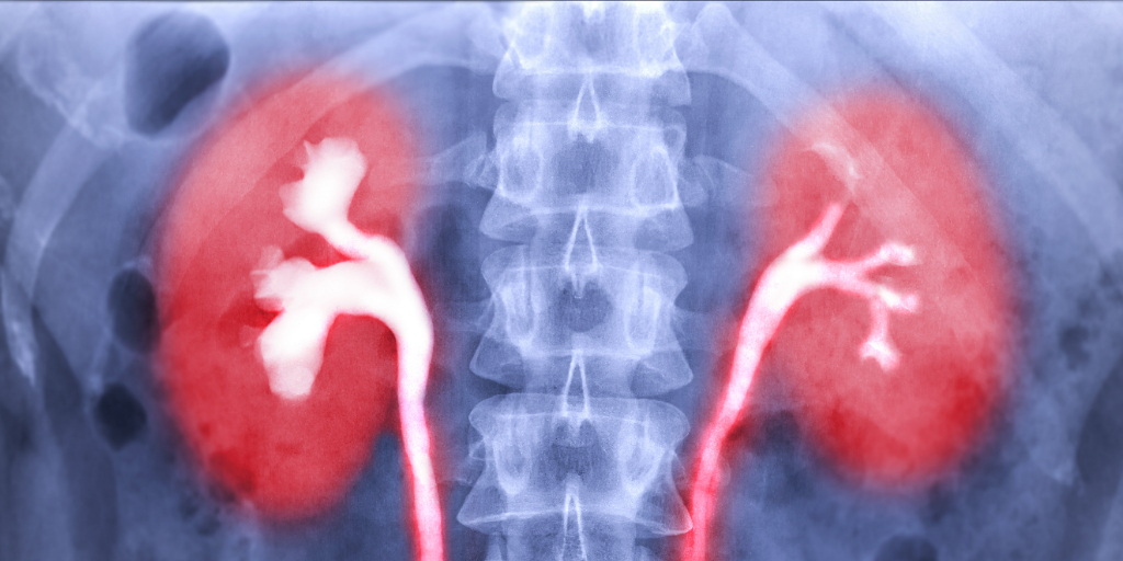 Contrast media image of kidneys